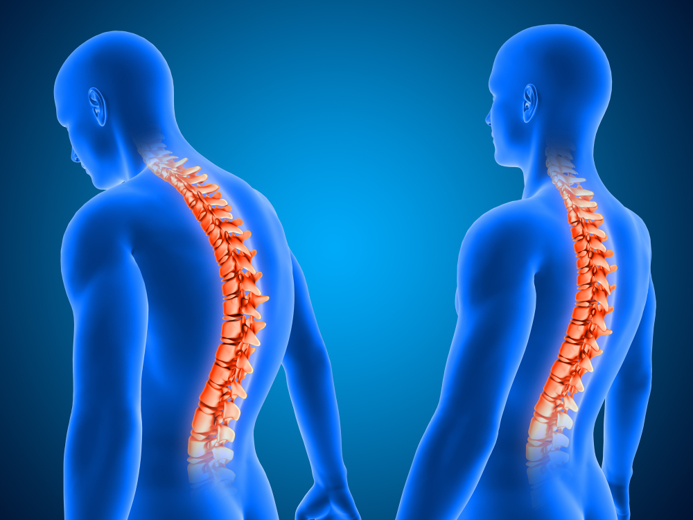 8 Great Exercises to Safeguard Your Spine